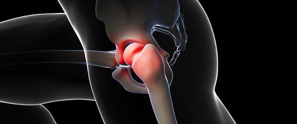 Piriformis Syndrome: It’s a Pain In the Butt, Hip, and Leg