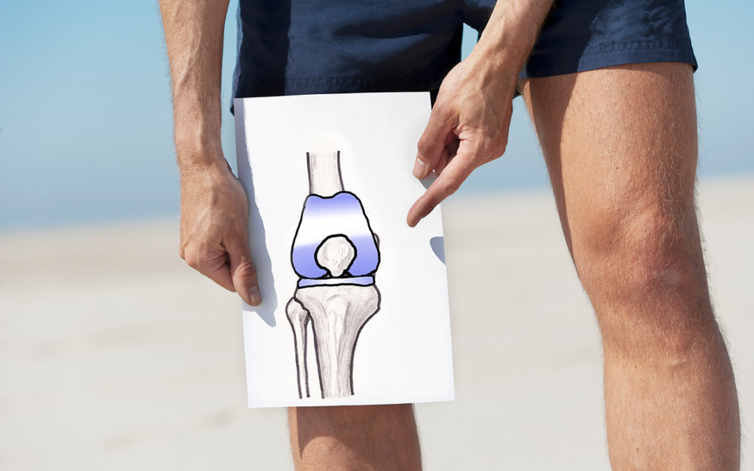 BACK ON TRACK: WORKING WITH CLIENTS FOLLOWING A KNEE REPLACEMENT: