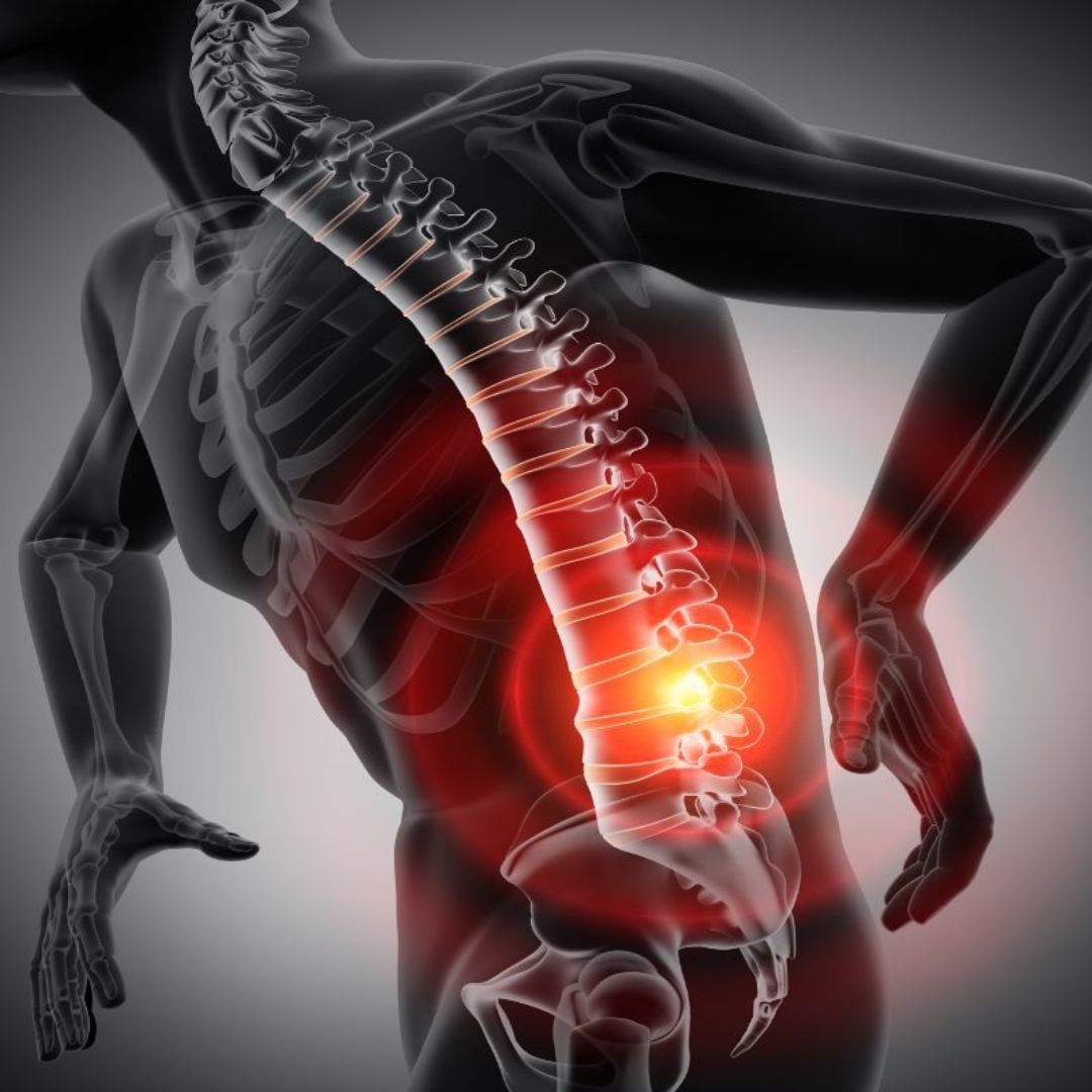Pain-Free Movement Specialist Level 1