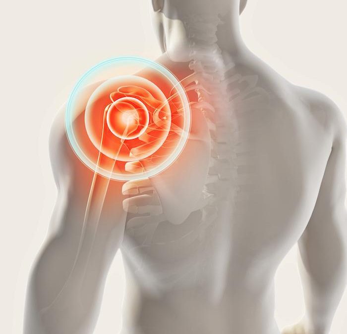 Top 3 Ways of Managing Shoulder Pain